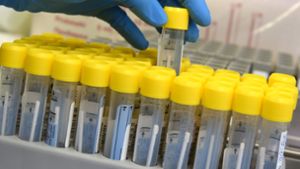 Aktuelle Daten zur Coronapandemie: Inzidenz, Intensivbetten, Verstorbene – die Coronadaten vom 5. Oktober