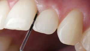 Zahnärzte aus dem Landkreis: Kein Patient wird abgewiesen